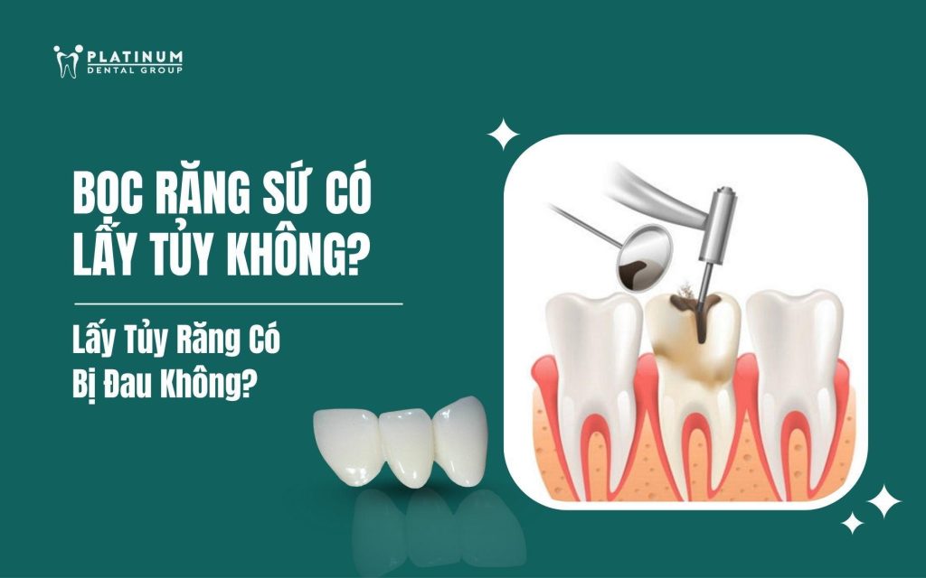bọc răng sứ có cần lấy tủy không