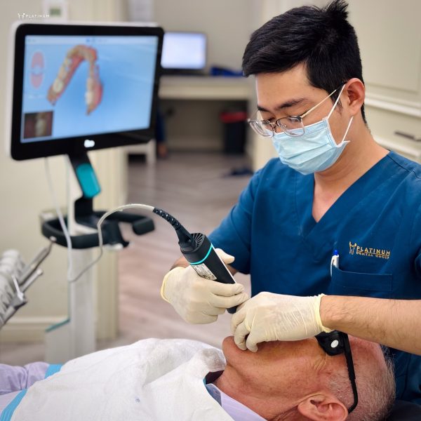 Dán răng sứ không mài - Giải pháp thẩm mỹ không xâm lấn 9 Sử dụng công nghệ scan 3D hiện đại để ghi nhận chính xác cấu trúc răng