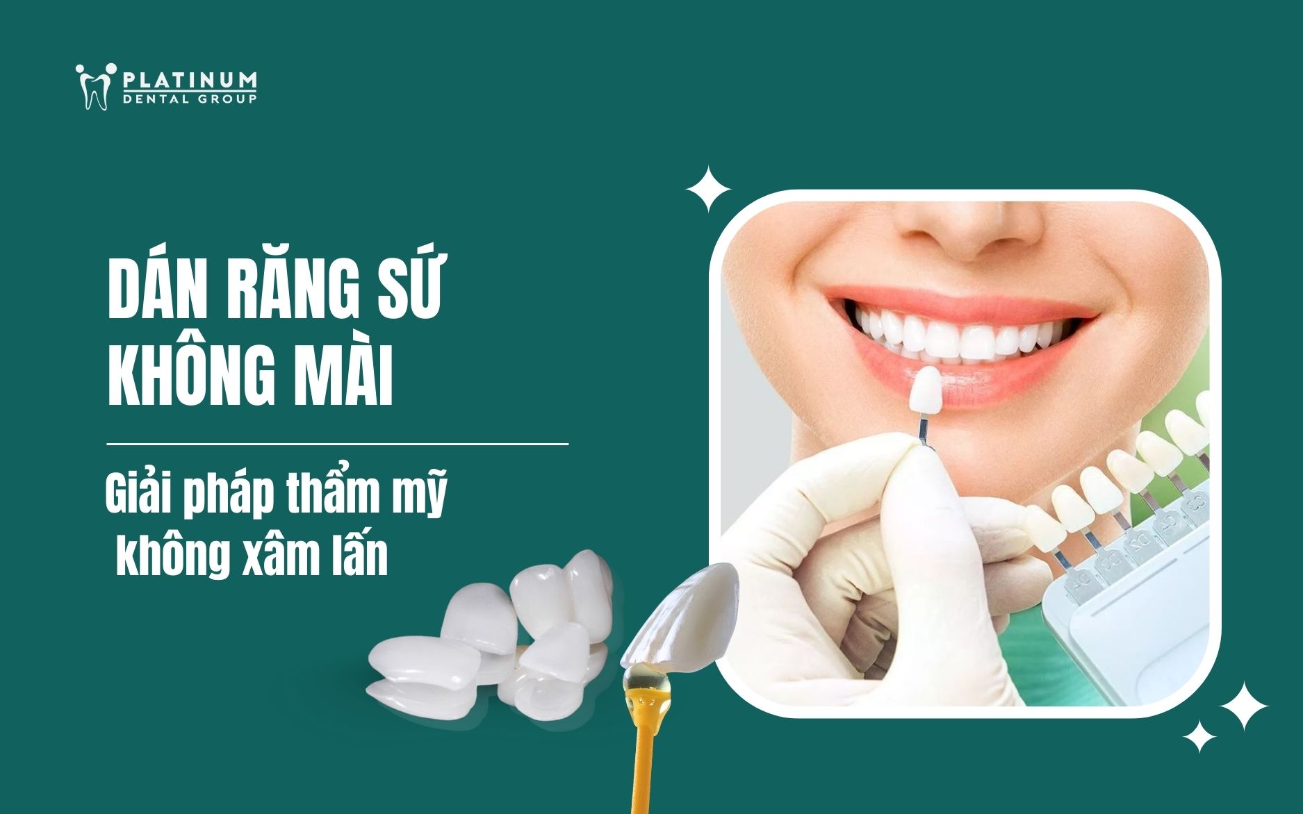 dán răng sứ không mài