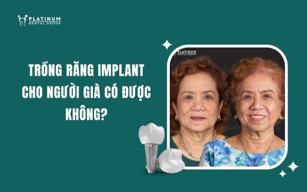 trồng răng implant cho người già