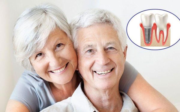 Trồng răng Implant có đau không? Có an toàn không cho người lớn tuổi?