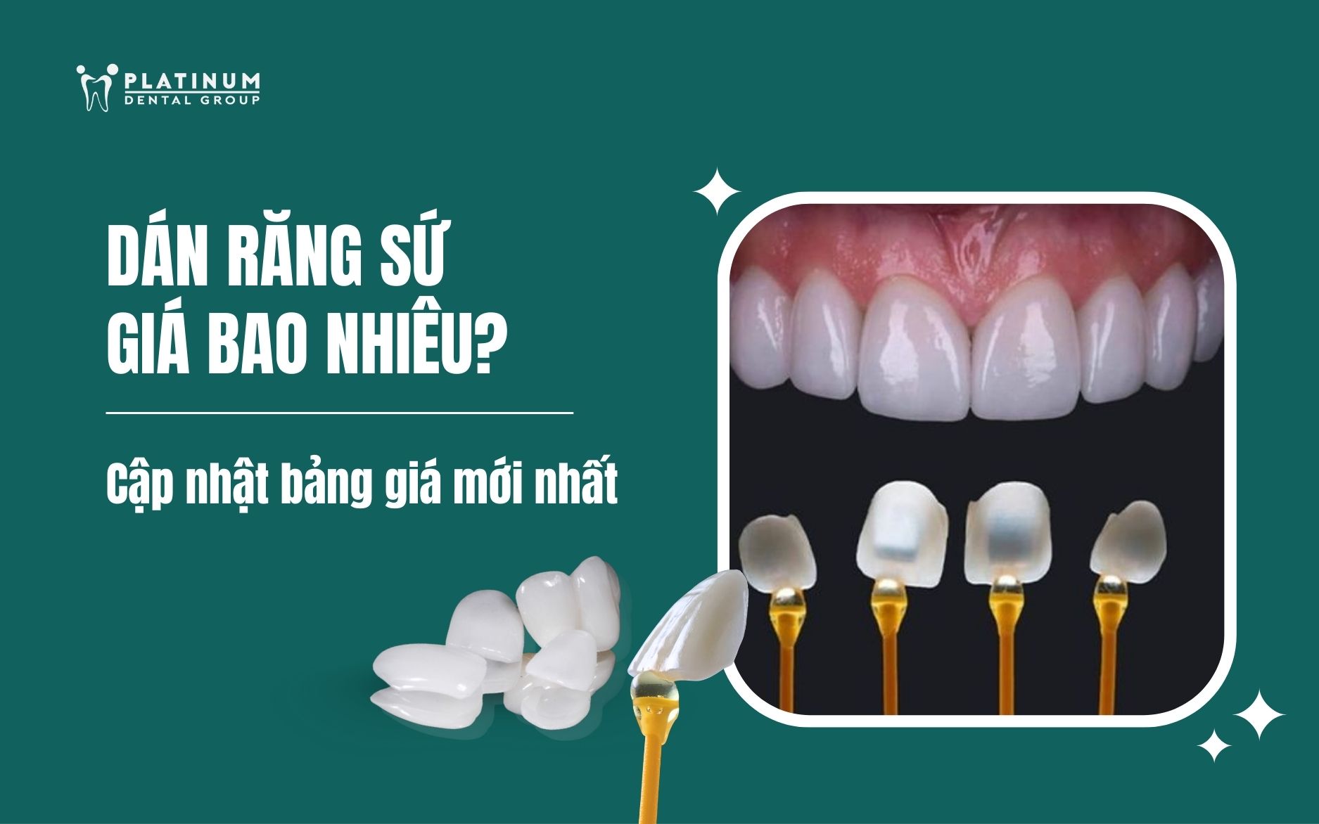 dán răng sứ giá bao nhiêu