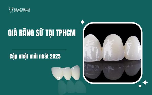 giá răng sứ