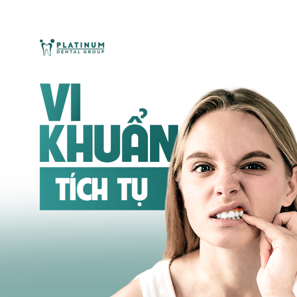 Răng sứ bị hở: Dấu hiệu, nguyên nhân và cách khắc phục hiệu quả 7 Các kẽ hở là nơi tích tụ vi khuẩn và mảng bám, tiềm ẩn nguy cơ đau nhức và hôi miệng kéo dài