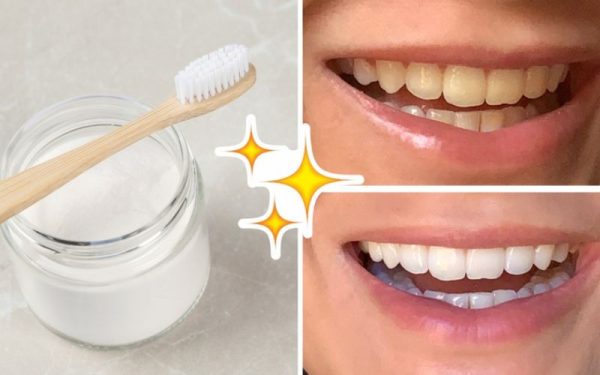 Bột Tẩy Trắng Răng Là Gì? Có Nên Dùng Bột Tẩy Trắng Răng? 21 Bột tẩy trắng răng là gì?