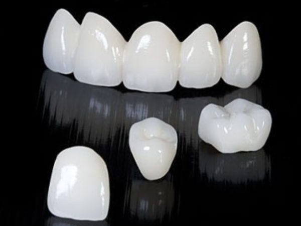 Răng toàn sứ được chế tác hoàn toàn từ sứ nguyên khối, không chứa kim loại