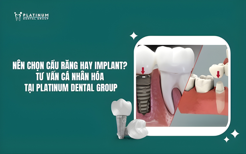 cầu răng và implant