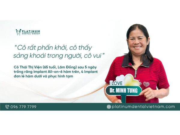 Hình ảnh cô T.V cười rạng rỡ sau 5 ngày trồng răng implant thành công tại Platinum Dental Group