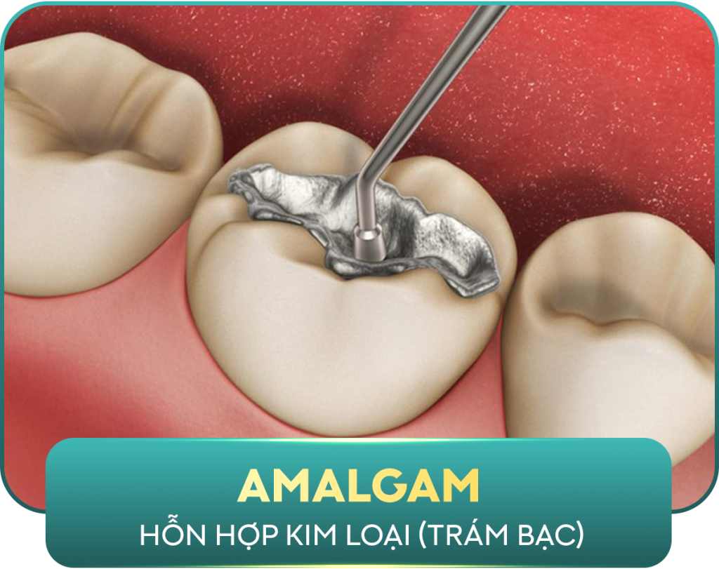 CÁC LOẠI VẬT LIỆU2