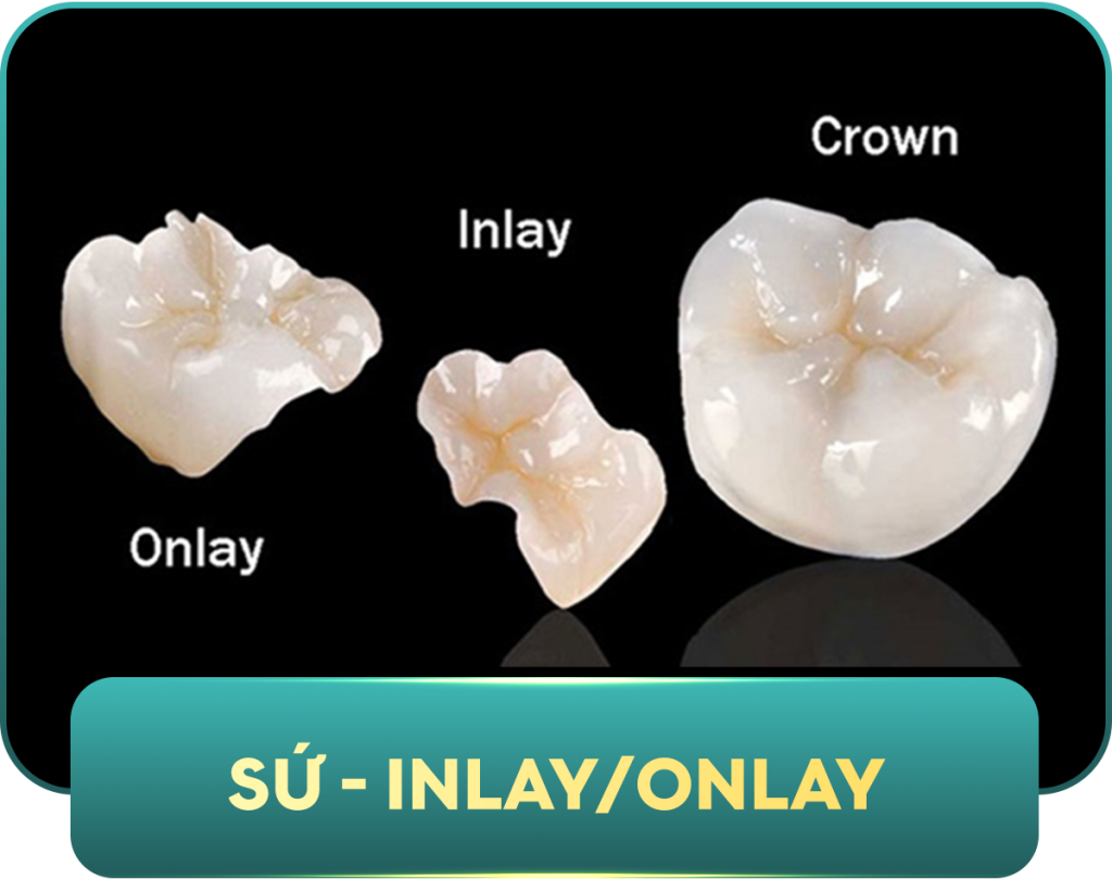 CÁC LOẠI VẬT LIỆU4