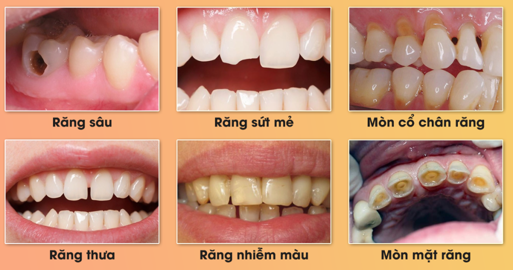KHI NÀO NÊN