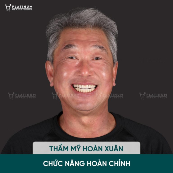 Cải thiện diện mạo tự nhiên