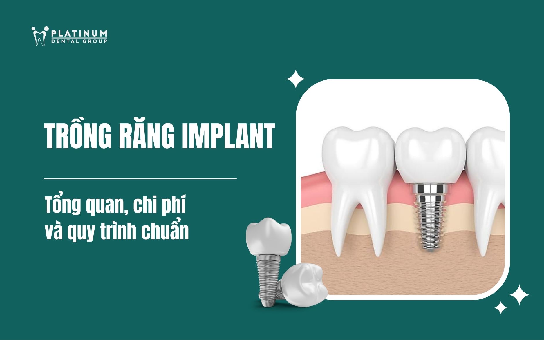 trồng răng implant