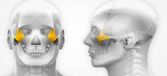 What is a zygoma implant? Advantages and disadvantages? Procedure? 2 Zygoma implant position