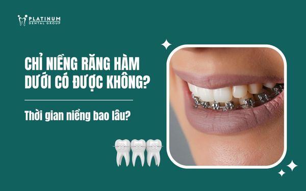 niềng răng hàm dưới