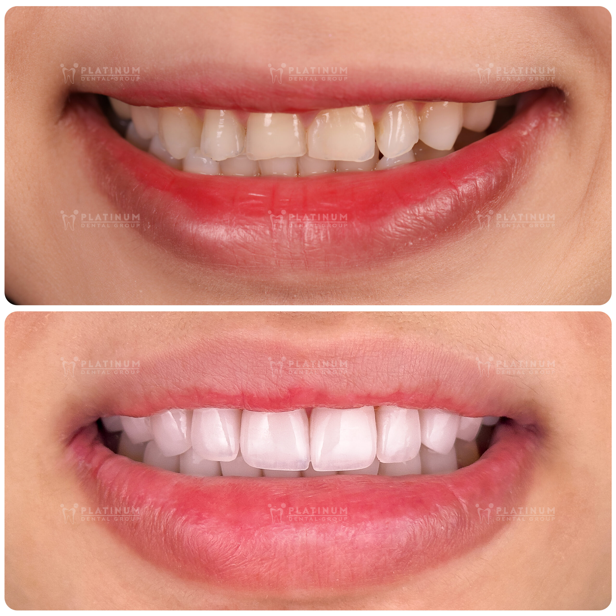 Vẻ đẹp tự nhiên, thẩm mỹ nổi bật