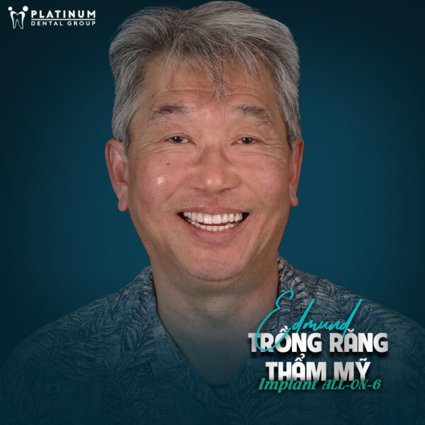 trong rang implant all on 6 6