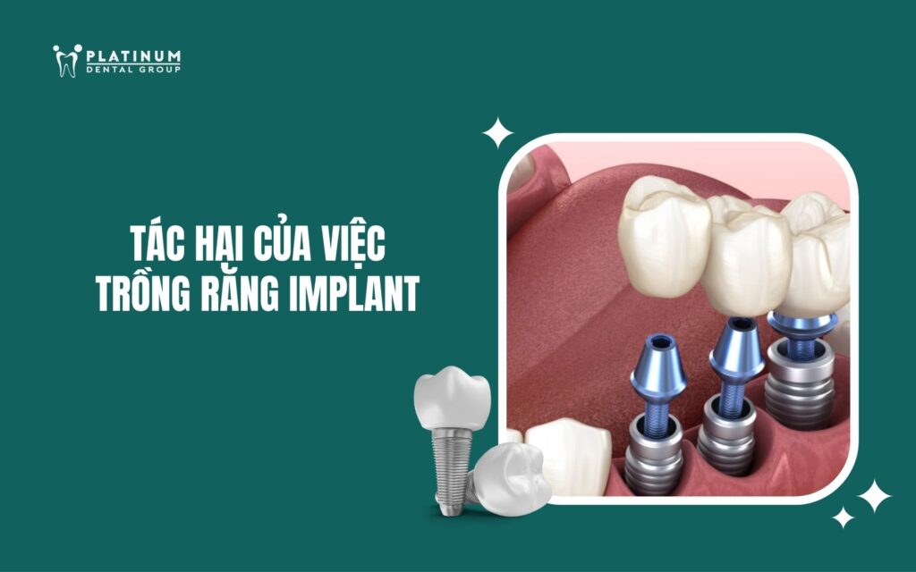 Tác hại của việc trồng răng Implant: Những biến chứng cần biết và cách phòng tránh