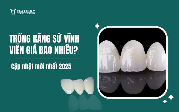 Chuyên gia giải đáp: Trồng răng sứ vĩnh viễn giá bao nhiêu?