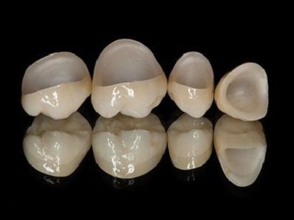 Gọi tên các biến chứng sau khi bọc răng sứ thường gặp và cách phòng tránh 5 Chất lượng vật liệu răng sứ ảnh hưởng trực tiếp đến tuổi thọ và độ an toàn của răng sau khi bọc