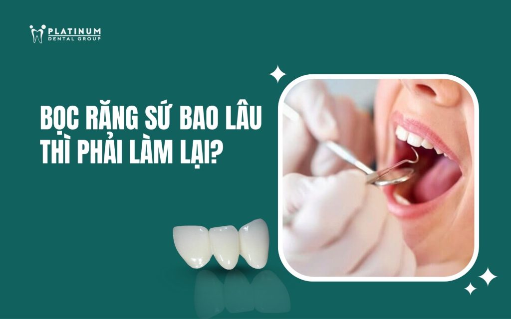 bọc răng sứ bao lâu thì phải làm lại
