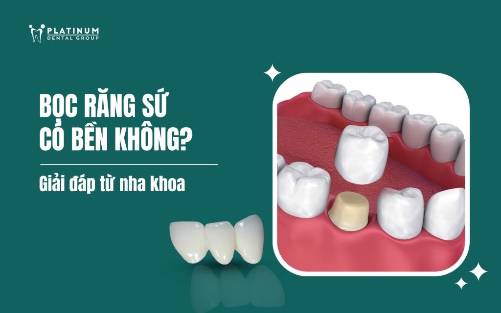 bọc răng sứ có bền không
