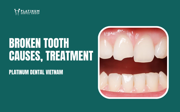 broken tooth