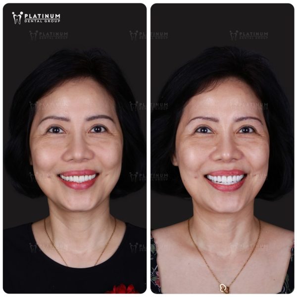 Mrs. Van Anh