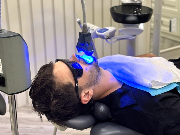 Teeth whitening service packages at Platinum Dental Group