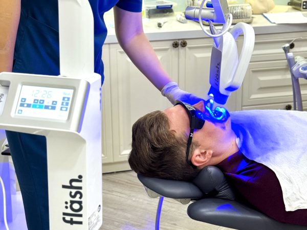 Steps of the teeth whitening procedure at Platinum Dental Group