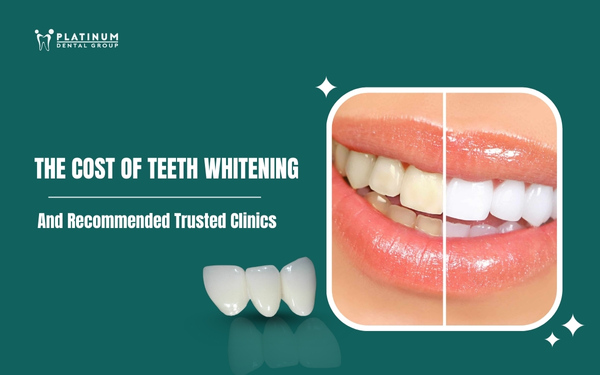 cost of teeth whitening