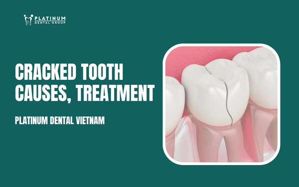 cracked tooth