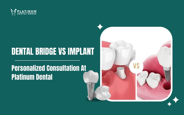 dental bridge vs implant