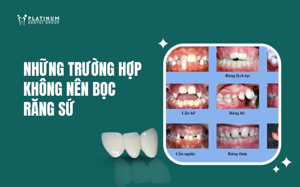 những trường hợp không nên bọc răng sứ