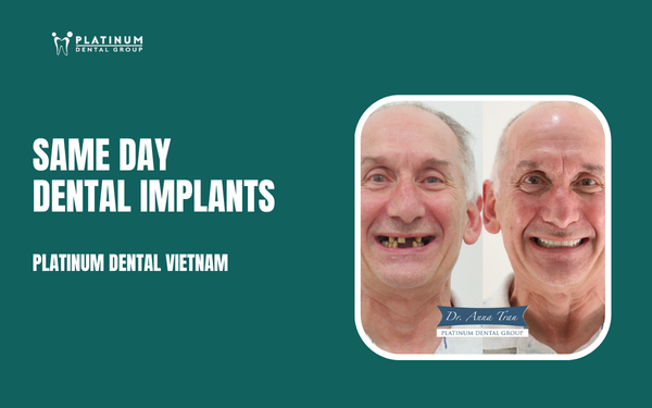 same day dental implants
