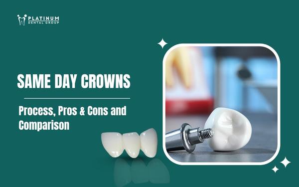 same day crowns