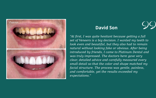 What Do Clients Say About Platinum Dental? David Son
