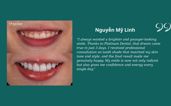 What Do Clients Say About Platinum Dental? Nguyễn Mỹ Linh
