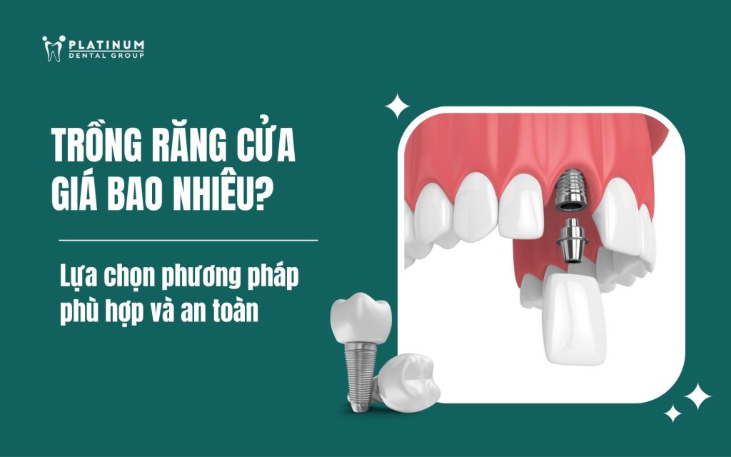trồng răng cửa bao nhiêu tiền