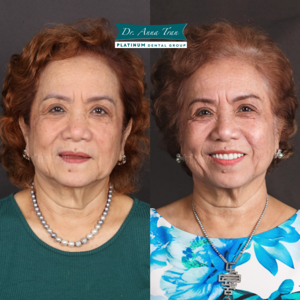 Thousands of Customers Have Chosen Platinum Dental Group 2