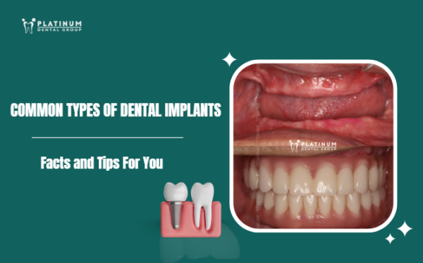 types of dental implants