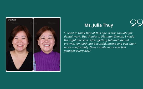 Veneers vs Crowns Ms. Julia Thuy