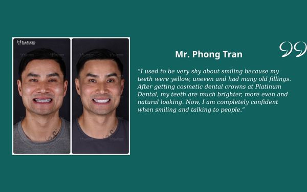 Veneers vs Crowns Mr. Phong Tran