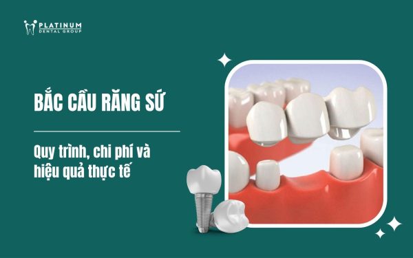 bắc cầu răng sứ