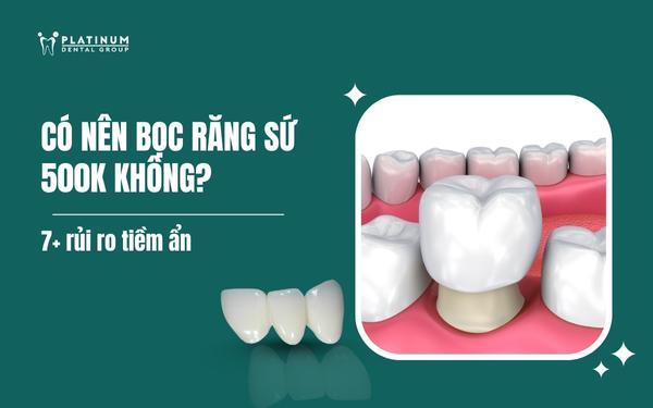 bọc răng sứ 500k