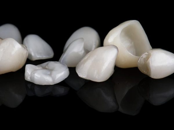 Có nên bọc răng sứ 500k không? 7+ rủi ro tiềm ẩn 1 Răng sứ 500k thường dùng vật liệu không rõ nguồn gốc, thiếu chứng nhận an toàn