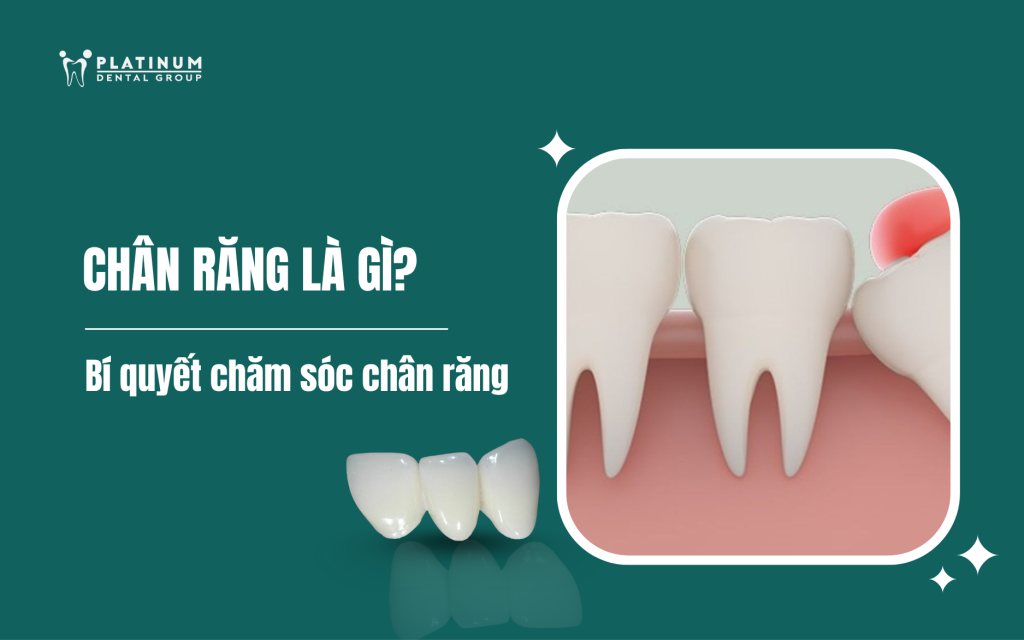 chân răng