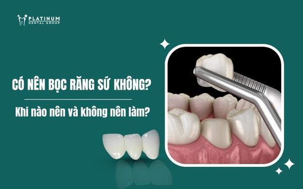 có nên bọc răng sứ không