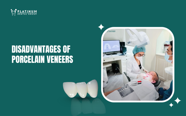 disadvantages of porcelain veneers