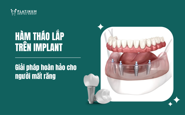 hàm tháo lắp trên implant